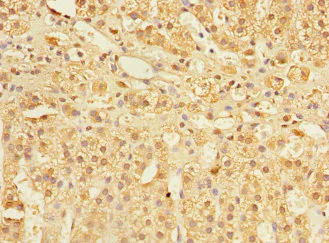 Immunohistochemistry (Formalin/PFA-fixed paraffin-embedded sections) - Anti-COMMD1/MURR1 antibody (AB224727)