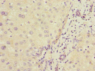 Immunohistochemistry (Formalin/PFA-fixed paraffin-embedded sections) - Anti-COMMD1/MURR1 antibody (AB224727)