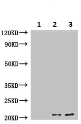 Immunoprecipitation - Anti-COMMD1/MURR1 antibody (AB224727)
