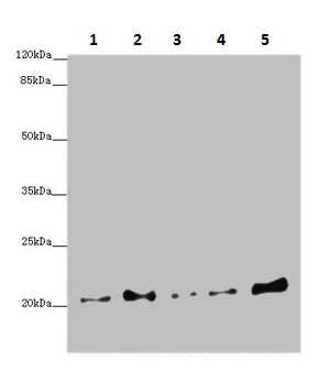 Western blot - Anti-COMMD1/MURR1 antibody (AB224727)