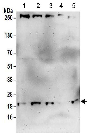 Western blot - Anti-COMMD3 antibody (AB176583)