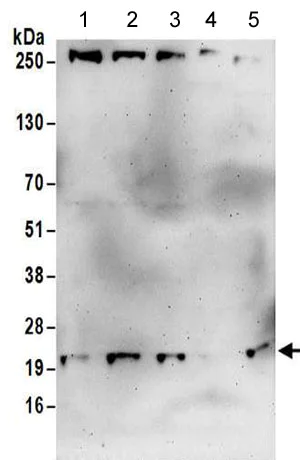 Western blot - Anti-COMMD3 antibody (AB176583)