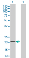 Western blot - Anti-COMMD3 antibody (AB67084)