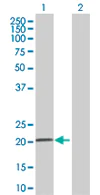 Western blot - Anti-COMMD3 antibody (AB67084)