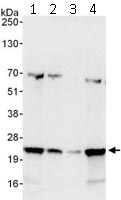 Western blot - Anti-COMMD4 antibody (AB115169)