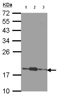 Western blot - Anti-COMMD7 antibody (AB96091)