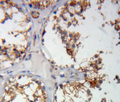 Immunohistochemistry (Formalin/PFA-fixed paraffin-embedded sections) - Anti-COMP/Cartilage oligomeric matrix protein antibody (AB231977)