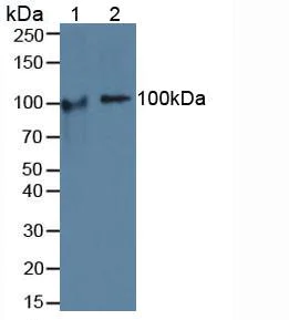 Western blot - Anti-COMP/Cartilage oligomeric matrix protein antibody (AB231977)