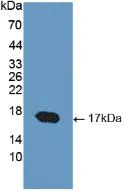 Western blot - Anti-COMP/Cartilage oligomeric matrix protein antibody (AB231977)