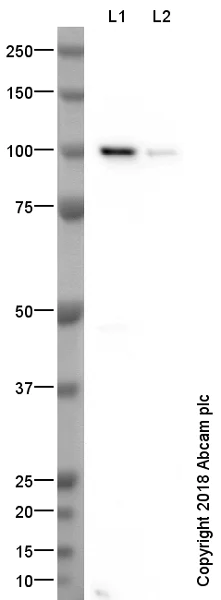Western blot - Anti-COMP/Cartilage oligomeric matrix protein antibody (AB74524)