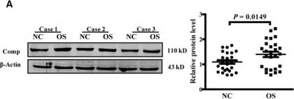 Western blot - Anti-COMP/Cartilage oligomeric matrix protein antibody (AB74524), expandable thumbnail