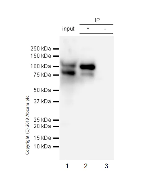 Immunoprecipitation - Anti-COMP/Cartilage oligomeric matrix protein antibody [EPR22857-38] (AB260037)