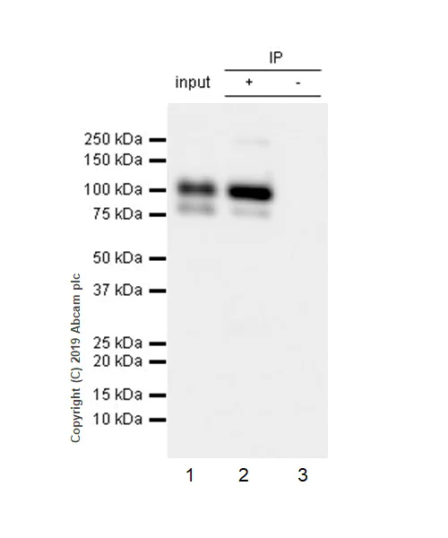 Immunoprecipitation - Anti-COMP/Cartilage oligomeric matrix protein antibody [EPR22857-38] (AB260037)