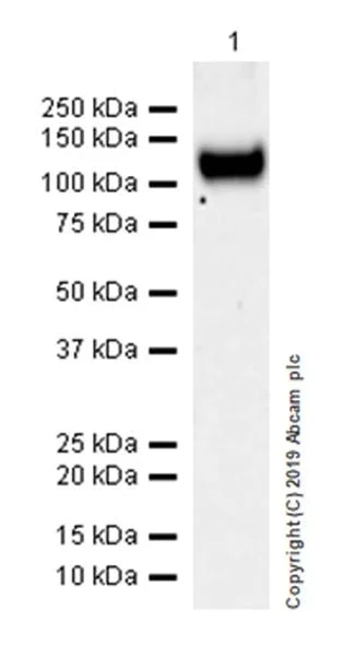 Western blot - Anti-COMP/Cartilage oligomeric matrix protein antibody [EPR22857-38] (AB260037)