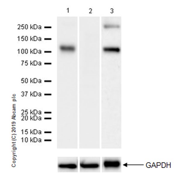 Western blot - Anti-COMP/Cartilage oligomeric matrix protein antibody [EPR22857-38] (AB260037)