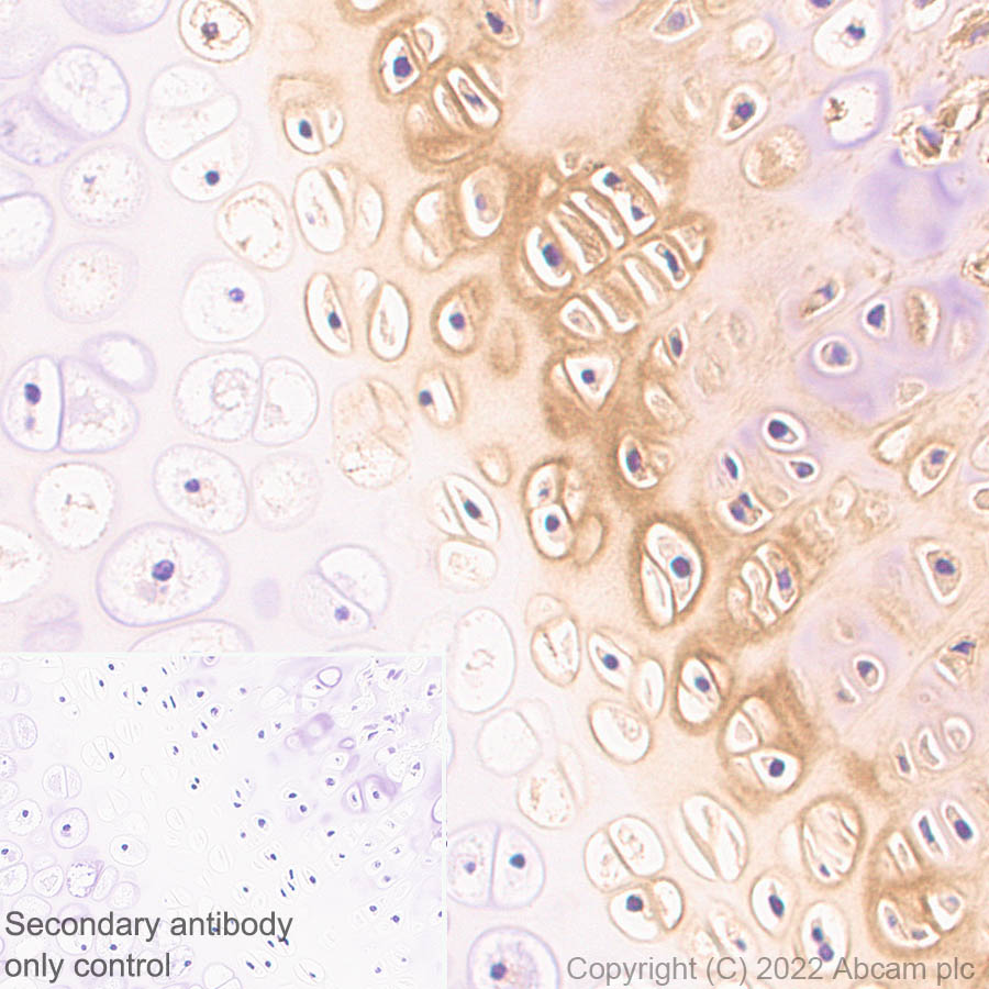Immunohistochemistry (Formalin/PFA-fixed paraffin-embedded sections) - Anti-COMP/Cartilage oligomeric matrix protein antibody [EPR25364-6] (ab300555), expandable thumbnail