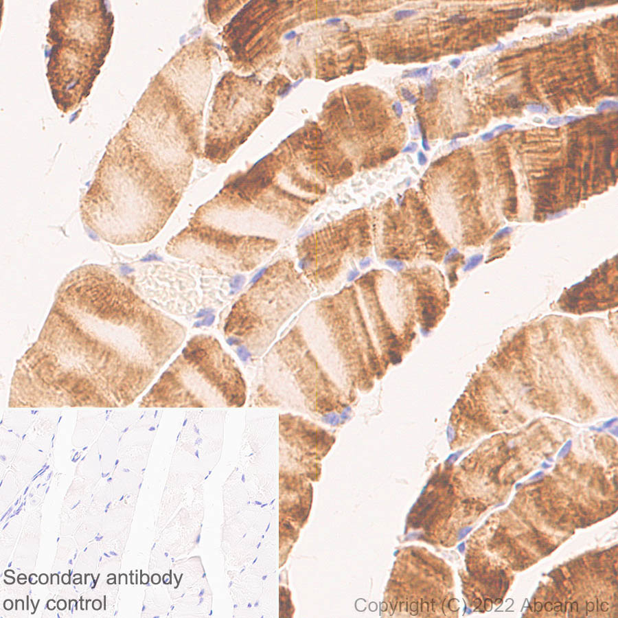 Immunohistochemistry (Formalin/PFA-fixed paraffin-embedded sections) - Anti-COMP/Cartilage oligomeric matrix protein antibody [EPR25364-6] (ab300555), expandable thumbnail