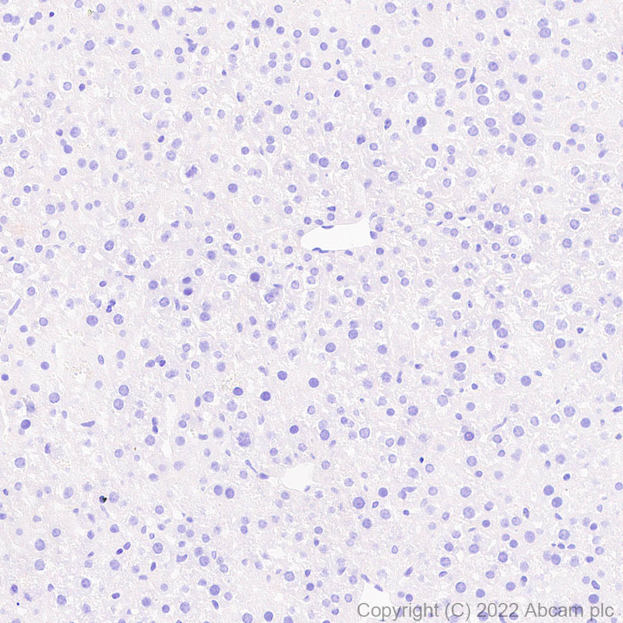 Immunohistochemistry (Formalin/PFA-fixed paraffin-embedded sections) - Anti-COMP/Cartilage oligomeric matrix protein antibody [EPR25364-6] (ab300555), expandable thumbnail