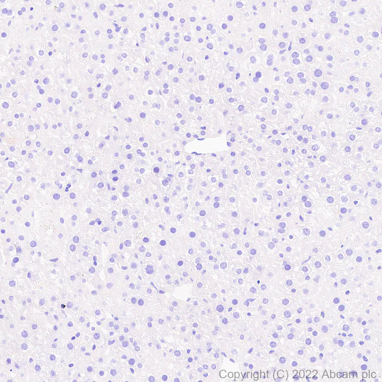 Immunohistochemistry (Formalin/PFA-fixed paraffin-embedded sections) - Anti-COMP/Cartilage oligomeric matrix protein antibody [EPR25364-6] (AB300555)