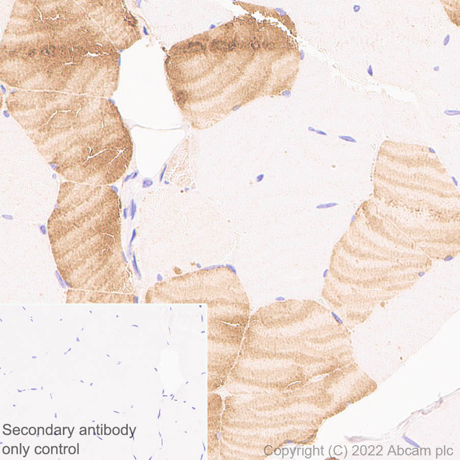 Immunohistochemistry (Formalin/PFA-fixed paraffin-embedded sections) - Anti-COMP/Cartilage oligomeric matrix protein antibody [EPR25364-6] (ab300555), expandable thumbnail
