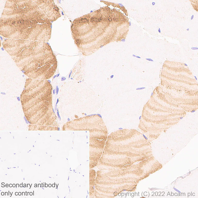 Immunohistochemistry (Formalin/PFA-fixed paraffin-embedded sections) - Anti-COMP/Cartilage oligomeric matrix protein antibody [EPR25364-6] (AB300555)