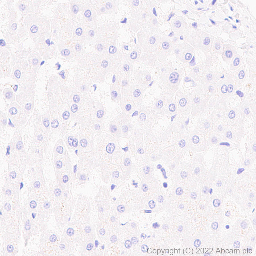 Immunohistochemistry (Formalin/PFA-fixed paraffin-embedded sections) - Anti-COMP/Cartilage oligomeric matrix protein antibody [EPR25364-6] (ab300555), expandable thumbnail