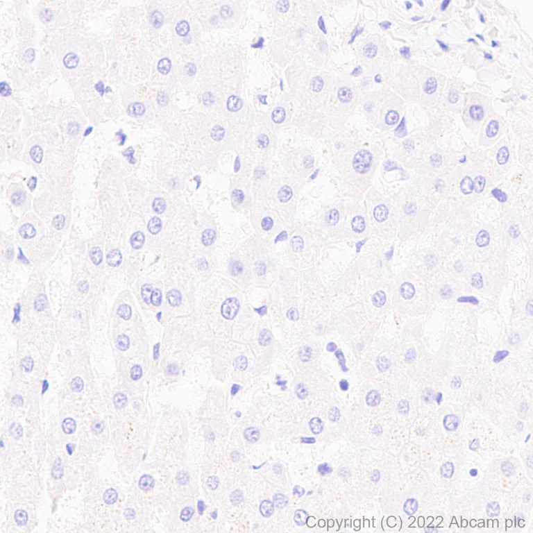 Immunohistochemistry (Formalin/PFA-fixed paraffin-embedded sections) - Anti-COMP/Cartilage oligomeric matrix protein antibody [EPR25364-6] (AB300555)