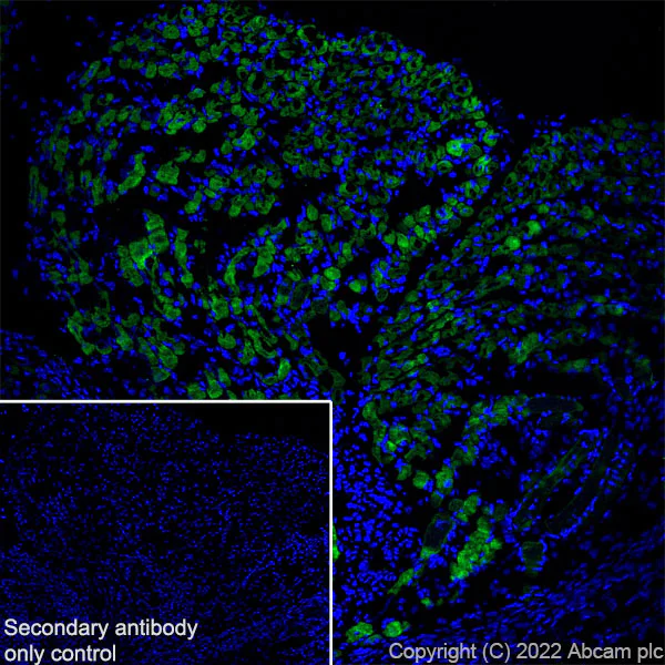 Immunohistochemistry (Frozen sections) - Anti-COMP/Cartilage oligomeric matrix protein antibody [EPR25364-6] (AB300555)