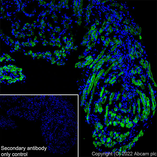 Immunohistochemistry (Frozen sections) - Anti-COMP/Cartilage oligomeric matrix protein antibody [EPR25364-6] (AB300555), expandable thumbnail