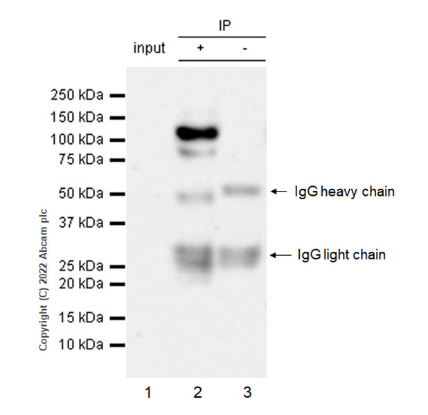 Immunoprecipitation - Anti-COMP/Cartilage oligomeric matrix protein antibody [EPR25364-6] (ab300555), expandable thumbnail