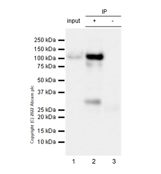Immunoprecipitation - Anti-COMP/Cartilage oligomeric matrix protein antibody [EPR25364-6] (ab300555), expandable thumbnail