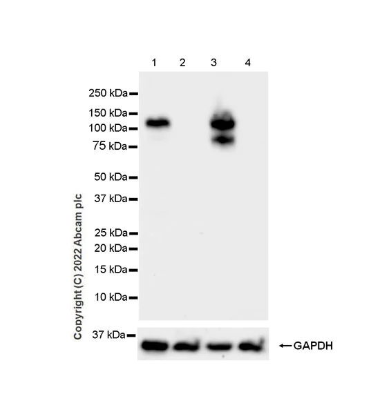 Western blot - Anti-COMP/Cartilage oligomeric matrix protein antibody [EPR25364-6] (AB300555)