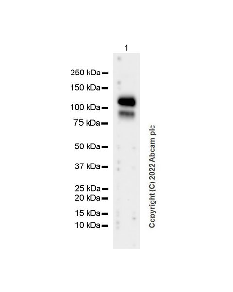 Western blot - Anti-COMP/Cartilage oligomeric matrix protein antibody [EPR25364-6] (AB300555), expandable thumbnail