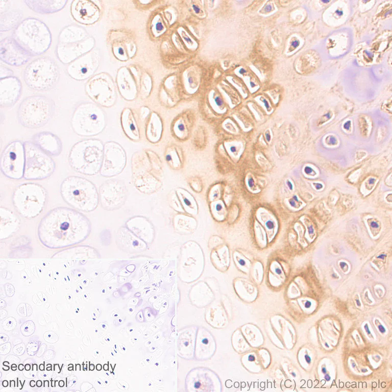 Immunohistochemistry (Formalin/PFA-fixed paraffin-embedded sections) - Anti-COMP/Cartilage oligomeric matrix protein antibody [EPR25364-6] (BSA and Azide free) (AB300556)