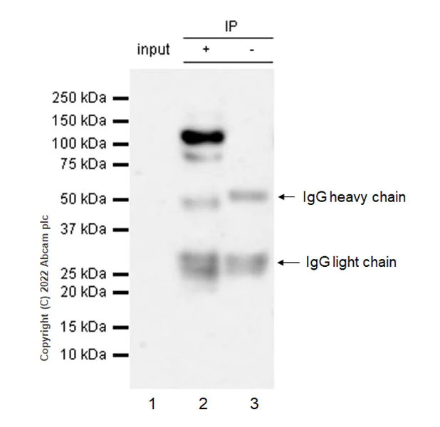 Immunoprecipitation - Anti-COMP/Cartilage oligomeric matrix protein antibody [EPR25364-6] (BSA and Azide free) (AB300556)