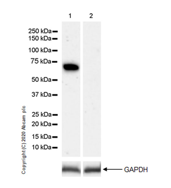 Western blot - Anti-Complement C8 antibody [EPR23646-22] (AB273626), expandable thumbnail