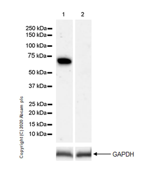 Western blot - Anti-Complement C8 antibody [EPR23646-22] (AB273626)