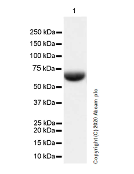Western blot - Anti-Complement C8 antibody [EPR23646-22] (AB273626)