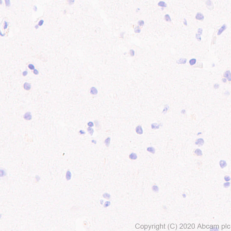 Immunohistochemistry (Formalin/PFA-fixed paraffin-embedded sections) - Anti-Complement factor 8 beta/C8B antibody [EPR23764-1] - BSA and Azide free (AB278049)