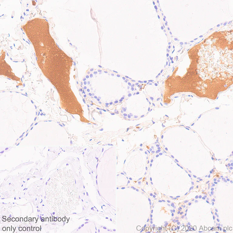 Immunohistochemistry (Formalin/PFA-fixed paraffin-embedded sections) - Anti-Complement factor 8 beta/C8B antibody [EPR23764-1] - BSA and Azide free (AB278049)