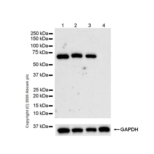 Western blot - Anti-Complement factor 8 beta/C8B antibody [EPR23764-1] - BSA and Azide free (AB278049)