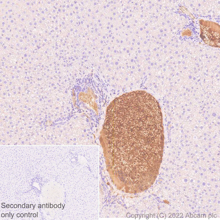 Immunohistochemistry (Formalin/PFA-fixed paraffin-embedded sections) - Anti-Complement factor B antibody [EPR27443-6] (AB309149)