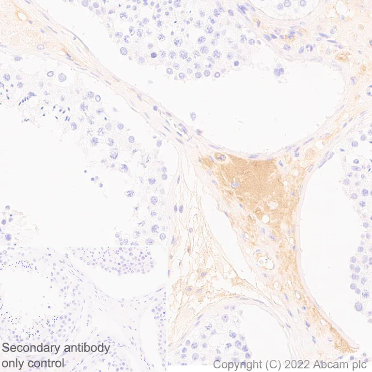 Immunohistochemistry (Formalin/PFA-fixed paraffin-embedded sections) - Anti-Complement factor B antibody [EPR27443-6] - BSA and Azide free (AB309150)