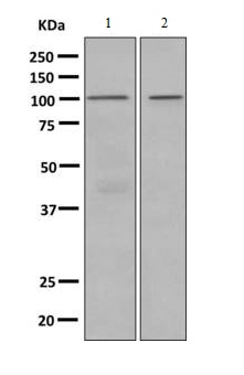 Western blot - Anti-Complement factor B antibody [EPR9287(B)] (AB140647)