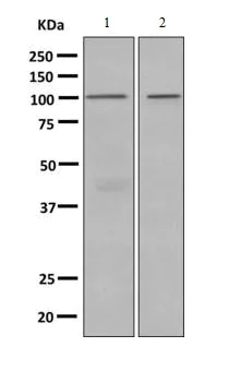 Western blot - Anti-Complement factor B antibody [EPR9287(B)] - BSA and Azide free (AB220417)