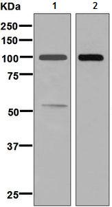 Western blot - Anti-Complement factor B antibody [EPR9288(B)] - BSA and Azide free (AB248646), expandable thumbnail