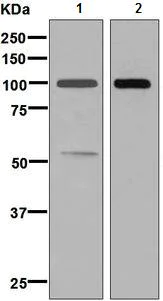 Western blot - Anti-Complement factor B antibody [EPR9288(B)] - BSA and Azide free (AB248646)