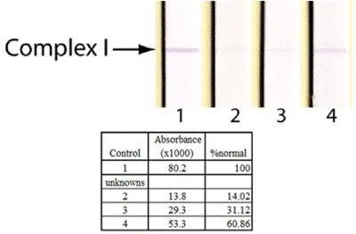 Functional Studies - Complex I Enzyme Activity Dipstick Assay Kit (AB109720)