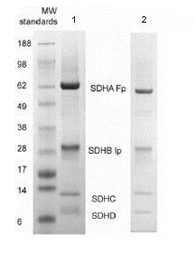 Immunoprecipitation - Anti-Complex II Immunocapture antibody [4H12BG12AG2] (AB109865), expandable thumbnail