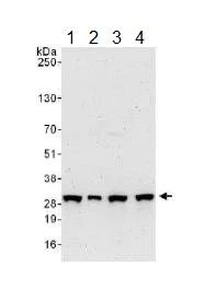 Western blot - Anti-COMT antibody (AB129504)